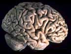 Image of a brain